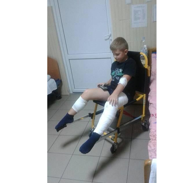 В пригороде Киева на людей нападает "собачья банда" В пригороде Киева на людей нападает "собачья банда"