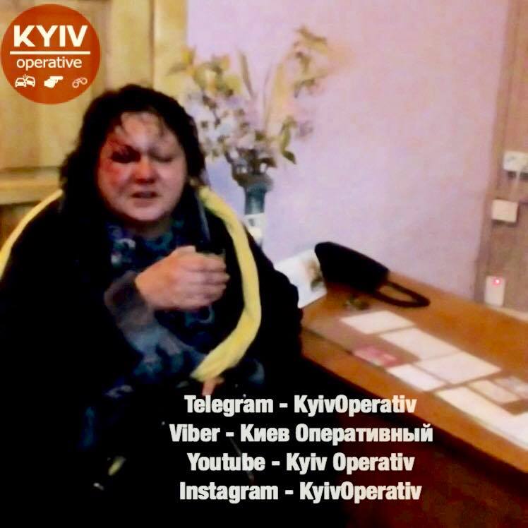 В киевской сауне мужчина выбил своей спутнице глаз В киевской сауне мужчина выбил своей спутнице глаз
