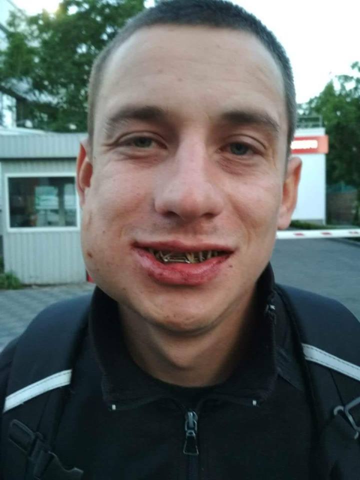 Полиция задержала отморозков, сломавших парню челюсть в столичном ТЦ Полиция задержала отморозков, сломавших парню челюсть в столичном ТЦ