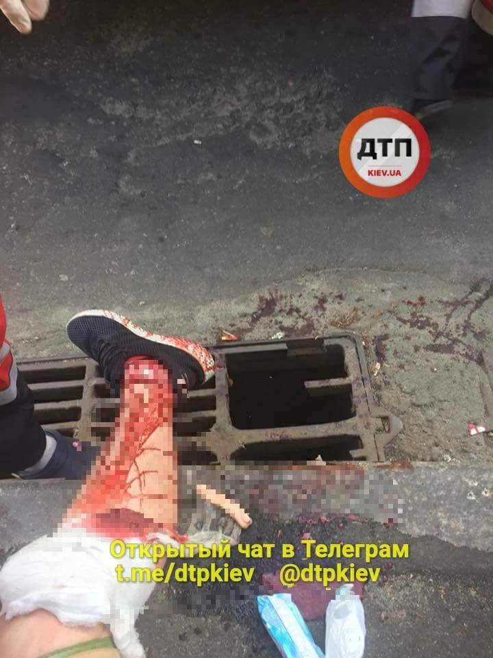 Ужасную травму ноги получил мужчина возле метро "Нивки" Ужасную травму ноги получил мужчина возле метро "Нивки"