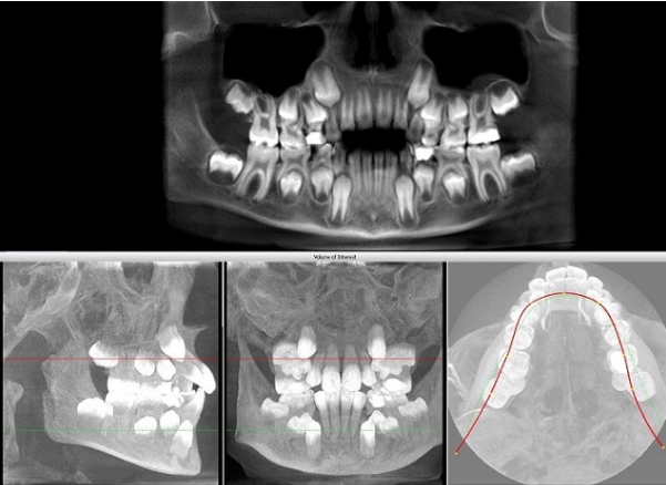 Компьютерная томография в стоматологии