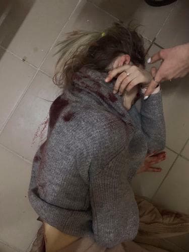 В Киеве неизвестный пытался изнасиловать девушку, а потом изрезал ее