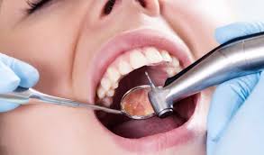 В КГГА сообщили, при каких условиях можно лечить зубы в период карантина
