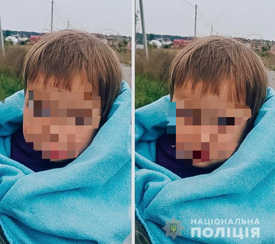 На Киевщине отец проморгал свою 3-летнюю дочь из многодетной семьи